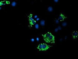 ACSF2 Monoclonal Antibody (OTI6E4), TrueMAB , OriGene 30 &mu;L; Unconjugated:Antibodies,