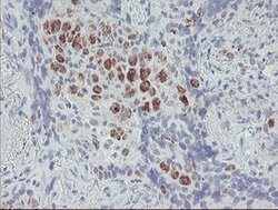 ACSF2 Mouse anti-Human, Clone: OTI6E4, lyophilized, TrueMAB 100 &mu;g;