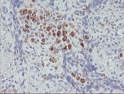 ACSF2 Monoclonal Antibody (OTI6E4), TrueMAB , OriGene:Antibodies:Primary