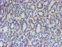 ACSF2 Mouse anti-Human, Clone: OTI6E4, lyophilized, TrueMAB 100 &mu;g;