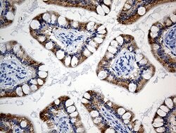 ACSL5 Monoclonal Antibody (OTI3A3), TrueMAB , OriGene 100 &mu;L; Unconjugated:Antibodies,