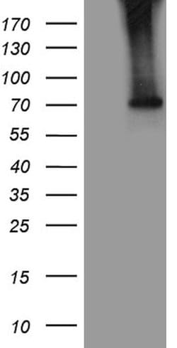 ACSL5 Monoclonal Antibody (OTI1D4), TrueMAB , OriGene:Antibodies:Primary