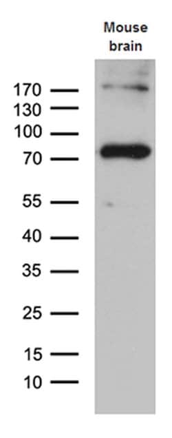 ACSL5 Monoclonal Antibody (OTI1C6), TrueMAB , OriGene:Antibodies:Primary