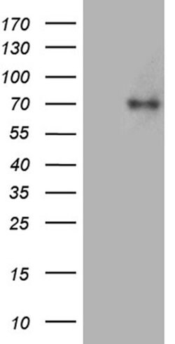 ACSL5 Monoclonal Antibody (OTI3A3), TrueMAB , OriGene:Antibodies:Primary