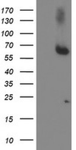 ACSM5 Monoclonal Antibody (OTI5D5), TrueMAB , OriGene:Antibodies:Primary