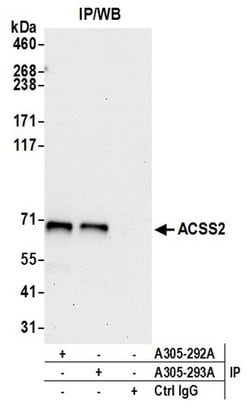 ACSS2/ACS Rabbit anti-Human, Polyclonal, Bethyl Laboratories 100 &mu;L | Buy Online | Bethyl Laboratories, Inc | Fisher Scientific