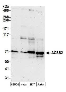 ACSS2/ACS Rabbit anti-Human, Polyclonal, Bethyl Laboratories 100 &mu;L;
