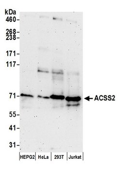 ACSS2/ACS Polyclonal Antibody, Bethyl Laboratories:Antibodies:Primary Antibodies