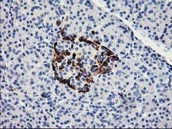 ACSS2 Mouse anti-Human, Clone: OTI3H4, liquid, TrueMAB 100 &mu;L; Unconjugated:Antibodies,