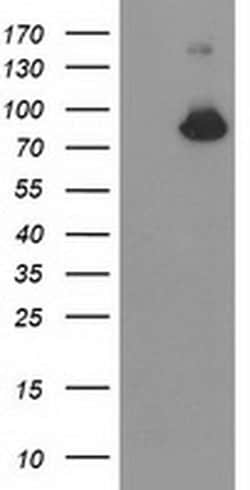 ACSS2 Monoclonal Antibody (OTI2E10), TrueMAB , OriGene 100 &mu;L; Unconjugated:Antibodies,