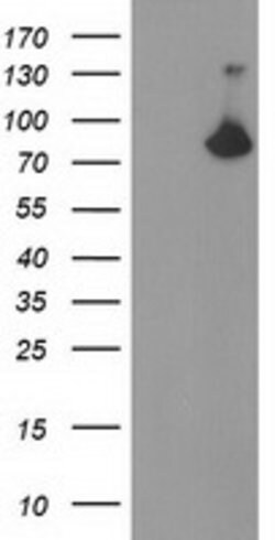 ACSS2 Mouse anti-Human, Clone: OTI3G3, lyophilized, TrueMAB 100 &mu;g;