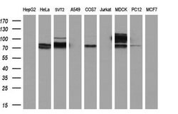ACSS2 Mouse anti-Human, Clone: OTI3H4, liquid, TrueMAB 100 &mu;L; Unconjugated:Antibodies,