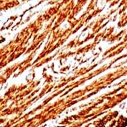 Smooth Muscle Actin, clone: 1A4, Invitrogen 1mL; Unconjugated:Anticorps,