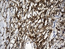 ACTA2 (smooth muscle actin alpha, SMA) Mouse anti-Human, Clone: UMAB237,