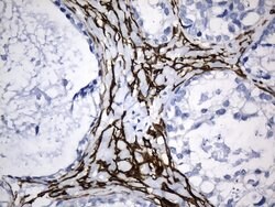 ACTA2 (smooth muscle actin alpha, SMA) Mouse anti-Human, Clone: UMAB237,
