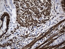 ACTA2 (smooth muscle actin alpha, SMA) Mouse anti-Human, Clone: UMAB237,