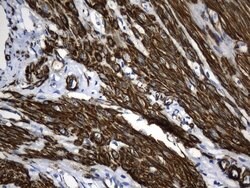 ACTA2 (smooth muscle actin alpha, SMA) Mouse anti-Human, Clone: UMAB237,