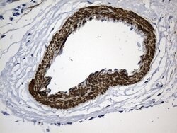 ACTA2 (smooth muscle actin alpha, SMA) Mouse anti-Human, Clone: UMAB237,