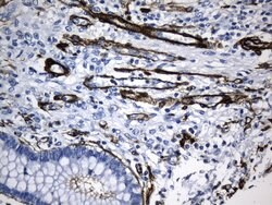 ACTA2 (smooth muscle actin alpha, SMA) Mouse anti-Human, Clone: UMAB237,