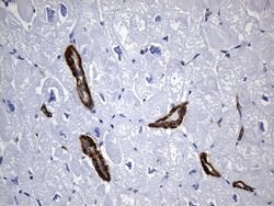 ACTA2 (smooth muscle actin alpha, SMA) Mouse anti-Human, Clone: UMAB237,