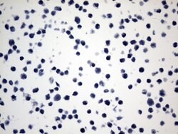 ACTA2 (smooth muscle actin alpha, SMA) Mouse anti-Human, Clone: UMAB237,