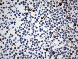 ACTA2 (smooth muscle actin alpha, SMA) Mouse anti-Human, Clone: UMAB237,