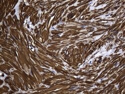 ACTA2 (smooth muscle actin alpha, SMA) Mouse anti-Human, Clone: UMAB237,