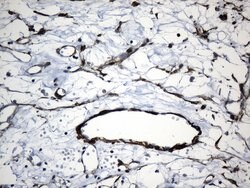 ACTA2 (smooth muscle actin alpha, SMA) Mouse anti-Human, Clone: UMAB237,