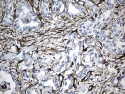 ACTA2 (smooth muscle actin alpha, SMA) Mouse anti-Human, Clone: UMAB237,