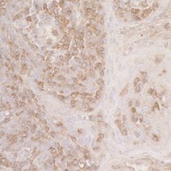 ACTR2/ARP2 Rabbit anti-Human, Polyclonal, Bethyl Laboratories 100 &mu;L;