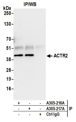 ACTR2/ARP2 Rabbit anti-Human, Polyclonal, Bethyl Laboratories 100 &mu;L;