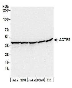 ACTR2/ARP2 Polyclonal Antibody, Bethyl Laboratories 20 &mu;L; Unconjugated:Antibodies,