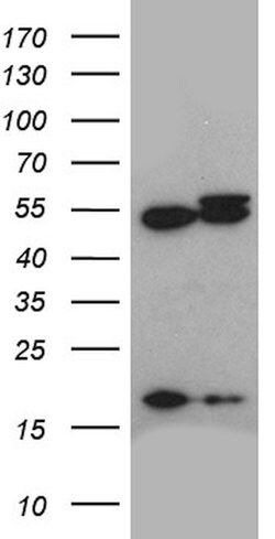 ACTR3 Monoclonal Antibody (OTI5G4), TrueMAB , OriGene 100 &mu;L; Unconjugated:Antibodies,