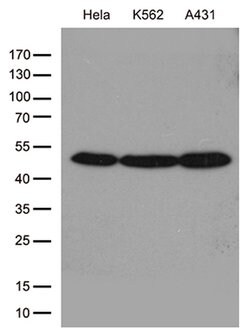 ACTR3 Monoclonal Antibody (OTI5G4), TrueMAB , OriGene:Antibodies:Primary
