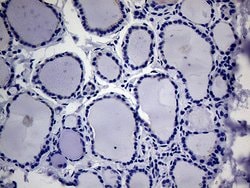ACVR2A Monoclonal Antibody (OTI1F2), TrueMAB , OriGene 100 &mu;L; Unconjugated:Antibodies,