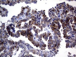ACVR2A Monoclonal Antibody (OTI1F2), TrueMAB , OriGene:Antibodies:Primary