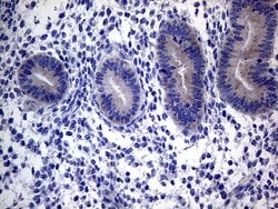 ACVR2A Monoclonal Antibody (OTI1F2), TrueMAB , OriGene:Antibodies:Primary