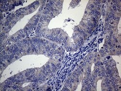 ACVR2A Monoclonal Antibody (OTI1F2), TrueMAB , OriGene 100 &mu;L; Unconjugated:Antibodies,
