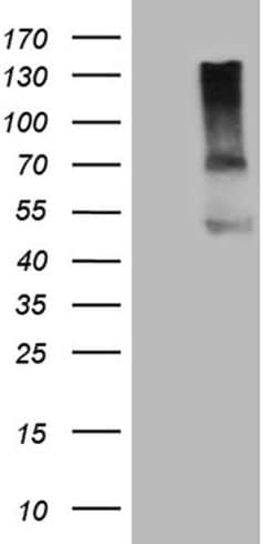 ACVR2A Monoclonal Antibody (OTI1F2), TrueMAB , OriGene 100 &mu;L; Unconjugated:Antibodies,
