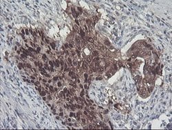 ACY1 Monoclonal Antibody (OTI2F1), TrueMAB , OriGene 100 &mu;L; Unconjugated:Antibodies,