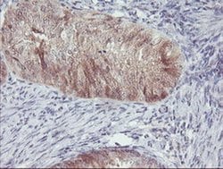 ACY1 Monoclonal Antibody (OTI2F1), TrueMAB , OriGene 100 &mu;L; Unconjugated:Antibodies,