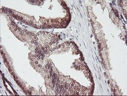 ACY1 Monoclonal Antibody (OTI2F1), TrueMAB , OriGene:Antibodies:Primary