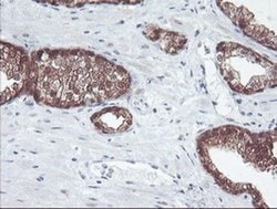 ACY1 Monoclonal Antibody (OTI2F1), TrueMAB , OriGene 100 &mu;L; Unconjugated:Antibodies,