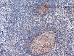ACY1 Monoclonal Antibody (OTI2F1), TrueMAB , OriGene:Antibodies:Primary