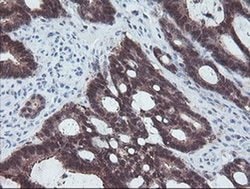 ACY1 Monoclonal Antibody (OTI2F1), TrueMAB , OriGene 100 &mu;L; Unconjugated:Antibodies,