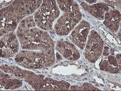 ACY1 Monoclonal Antibody (OTI2F1), TrueMAB , OriGene 100 &mu;L; Unconjugated:Antibodies,