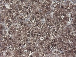 ACY1 Monoclonal Antibody (OTI2F1), TrueMAB , OriGene 100 &mu;L; Unconjugated:Antibodies,