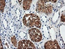 ACY1 Monoclonal Antibody (OTI1A12), TrueMAB , OriGene:Antibodies:Primary