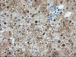 ACY1 Monoclonal Antibody (OTI1A12), TrueMAB , OriGene 100 &mu;L; Unconjugated:Antibodies,