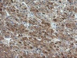 ACY1 Monoclonal Antibody (OTI1A12), TrueMAB , OriGene 100 &mu;L; Unconjugated:Antibodies,